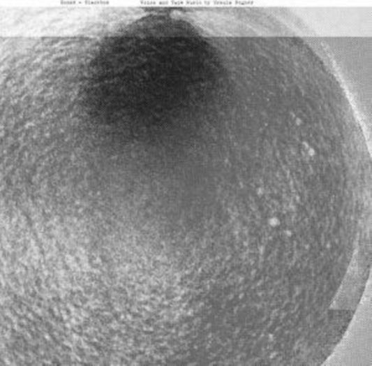 Ursula Bogner - Sonne = Blackbox